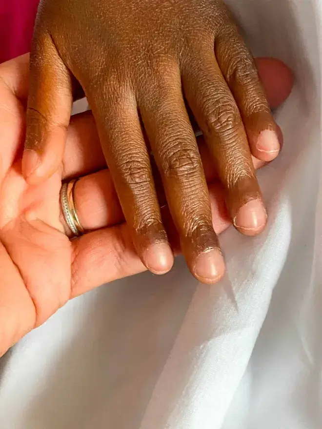mecenat-chirurgie-cardiaque-cameroun-marie-audrey-4.webp
